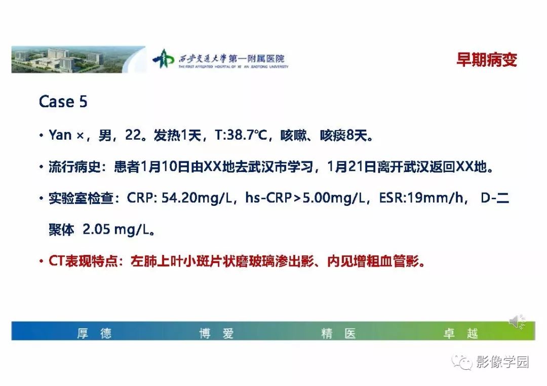 【PPT】输入性新冠肺炎的影像学特点与识别