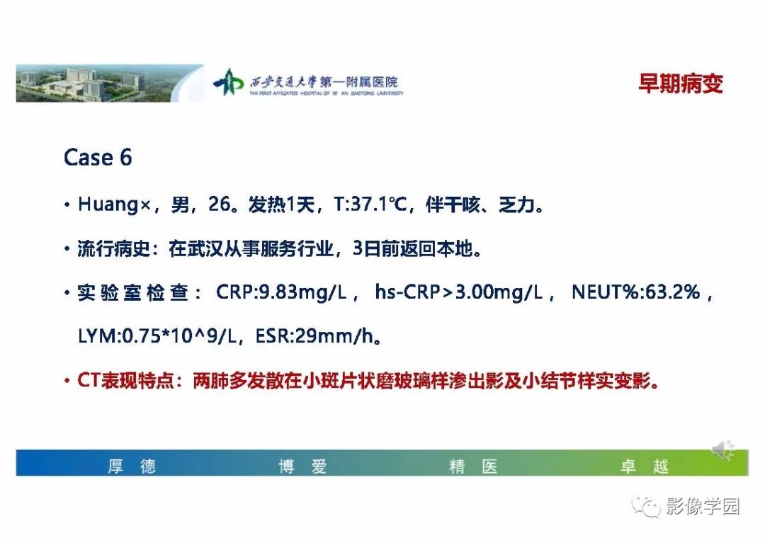 【PPT】输入性新冠肺炎的影像学特点与识别
