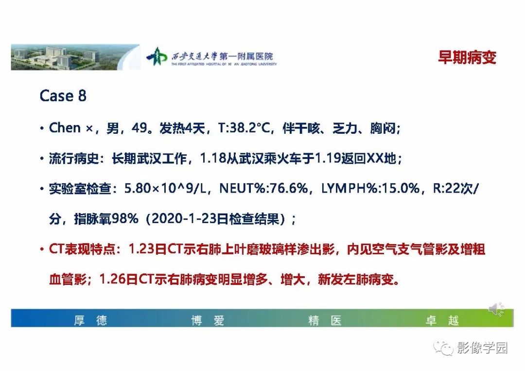 【PPT】输入性新冠肺炎的影像学特点与识别