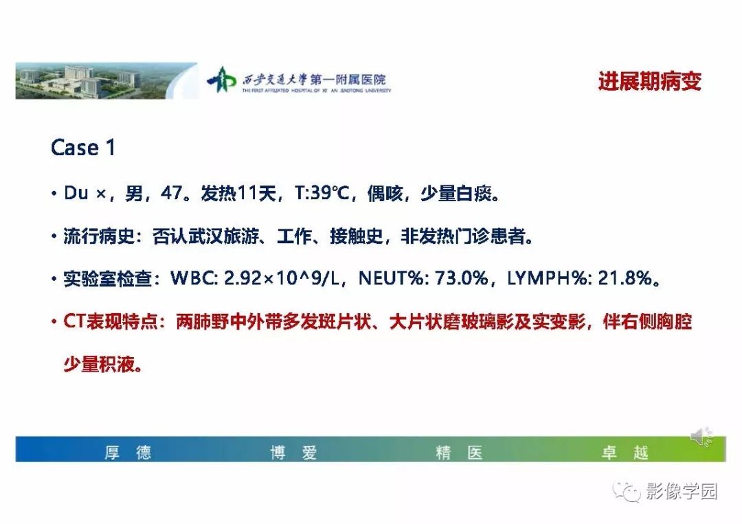 【PPT】输入性新冠肺炎的影像学特点与识别