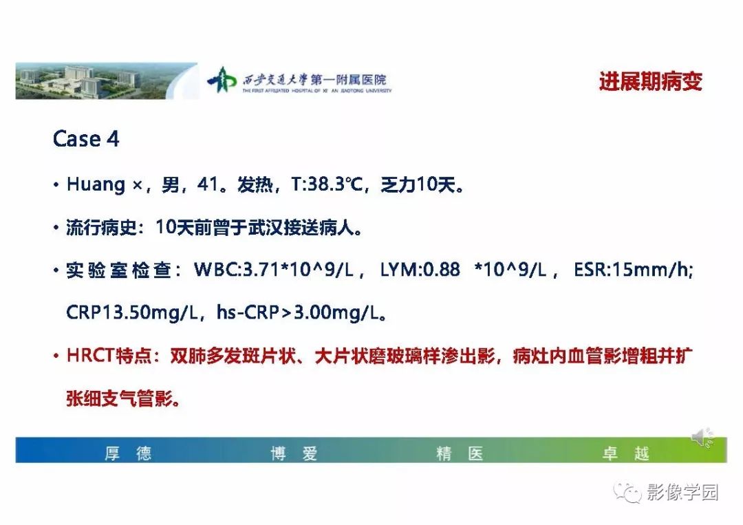 【PPT】输入性新冠肺炎的影像学特点与识别