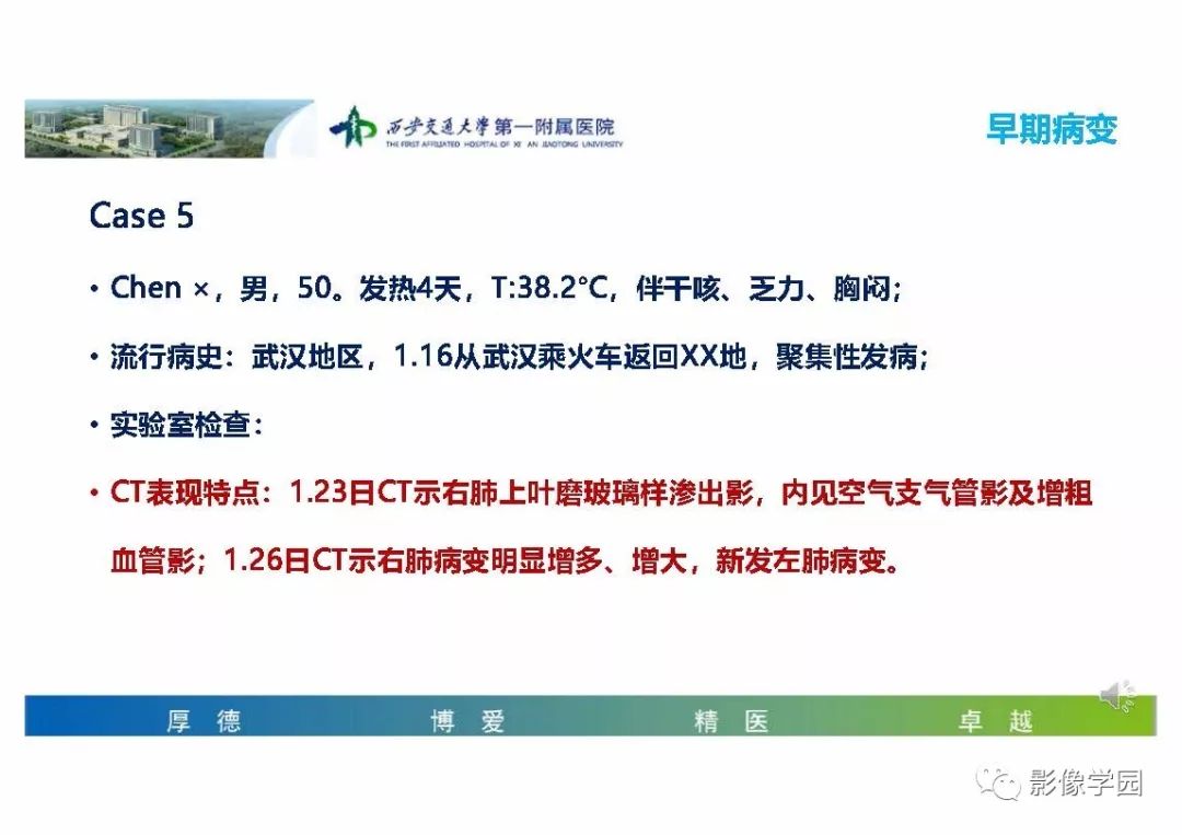 【PPT】输入性新冠肺炎的影像学特点与识别