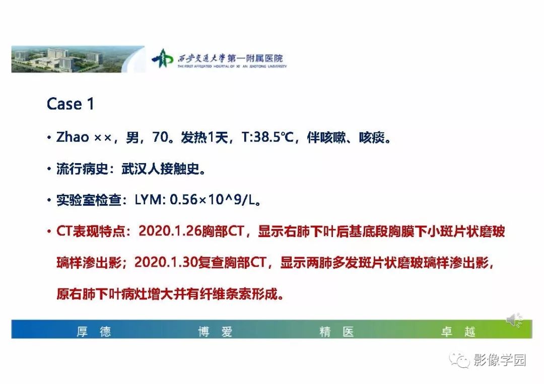 【PPT】输入性新冠肺炎的影像学特点与识别