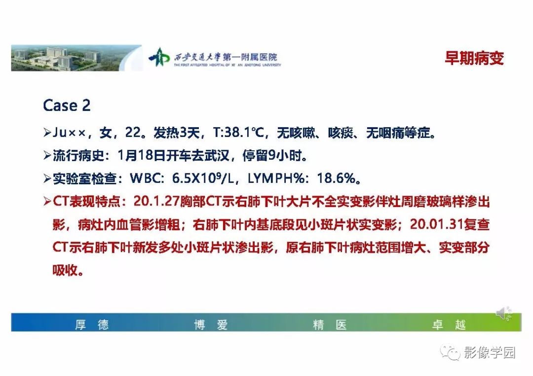 【PPT】输入性新冠肺炎的影像学特点与识别