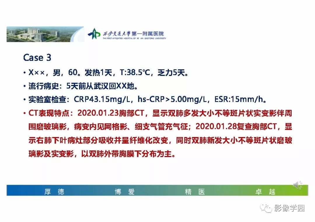 【PPT】输入性新冠肺炎的影像学特点与识别