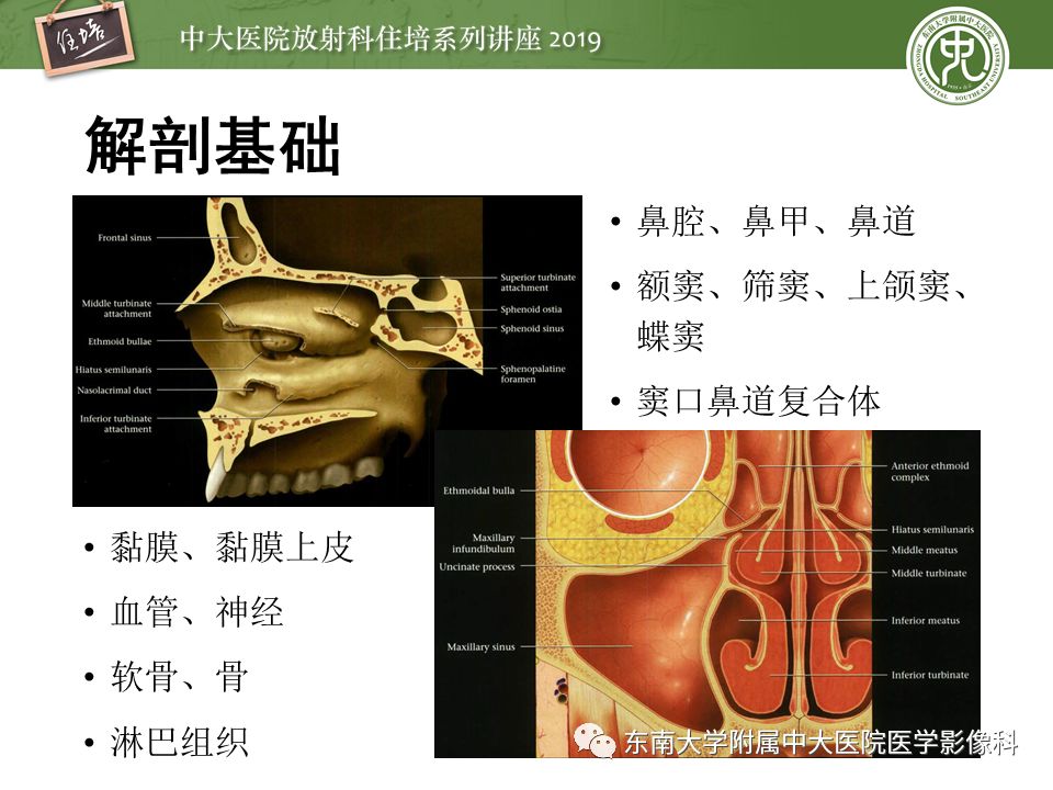 【PPT】鼻腔鼻窦恶性肿瘤影像诊断