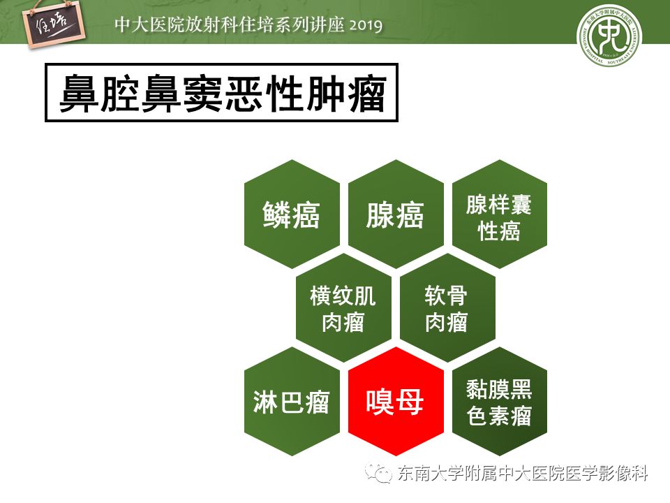 【PPT】鼻腔鼻窦恶性肿瘤影像诊断
