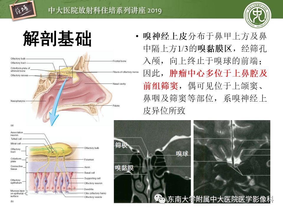 【PPT】鼻腔鼻窦恶性肿瘤影像诊断
