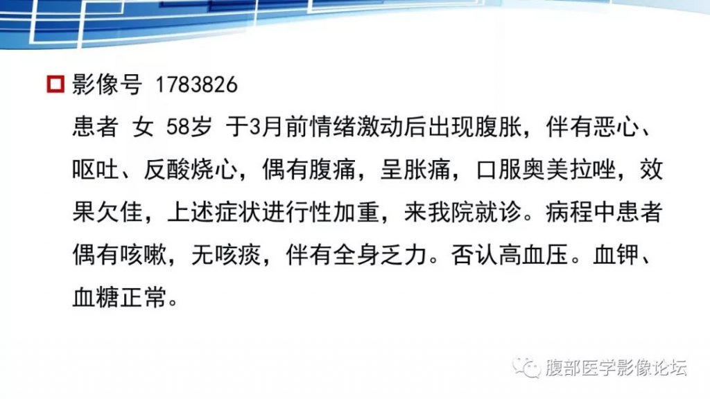 【PPT】腹膜后孤立性纤维瘤的影像