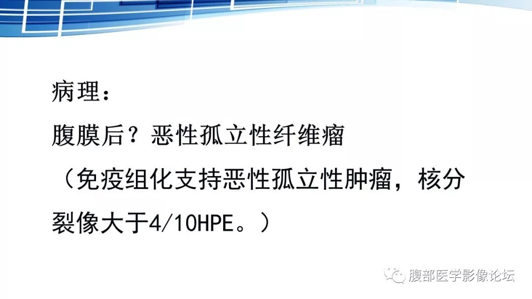 【PPT】腹膜后孤立性纤维瘤的影像