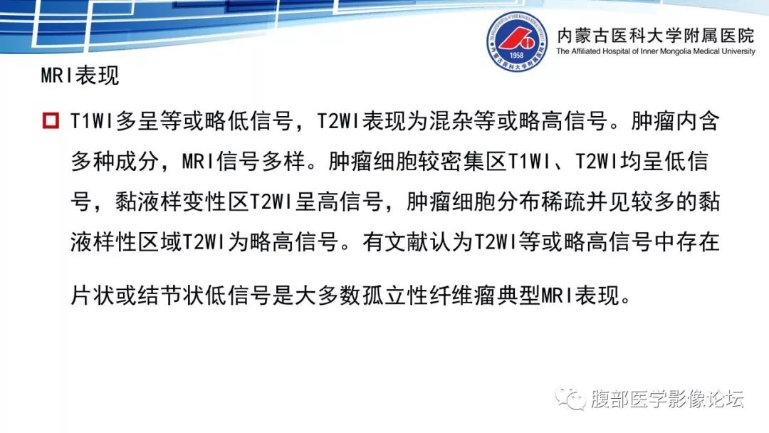 【PPT】腹膜后孤立性纤维瘤的影像