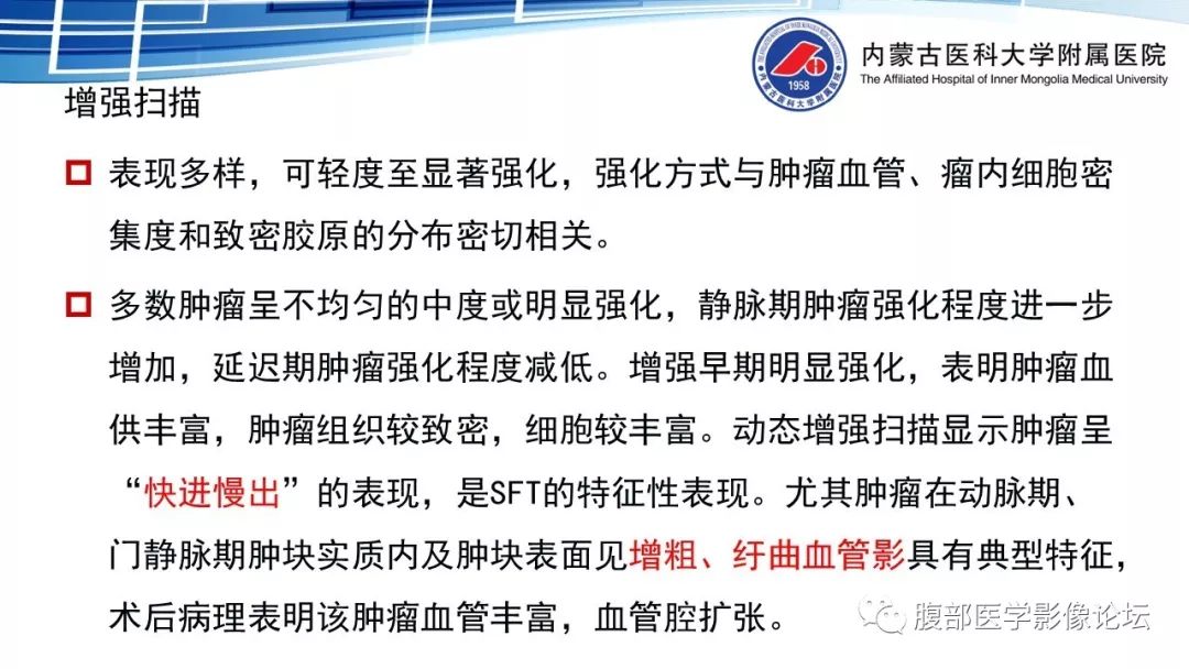 【PPT】腹膜后孤立性纤维瘤的影像