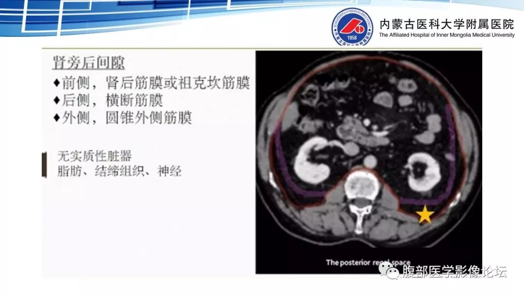 【PPT】腹膜后孤立性纤维瘤的影像