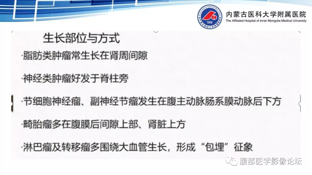 【PPT】腹膜后孤立性纤维瘤的影像