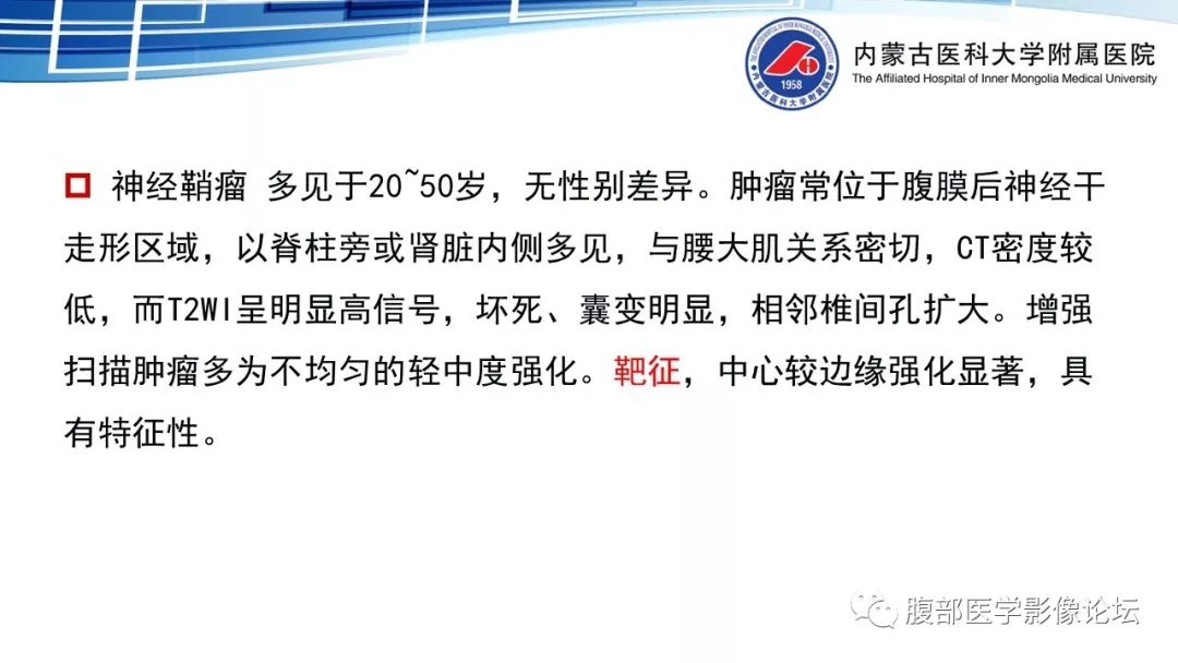 【PPT】腹膜后孤立性纤维瘤的影像