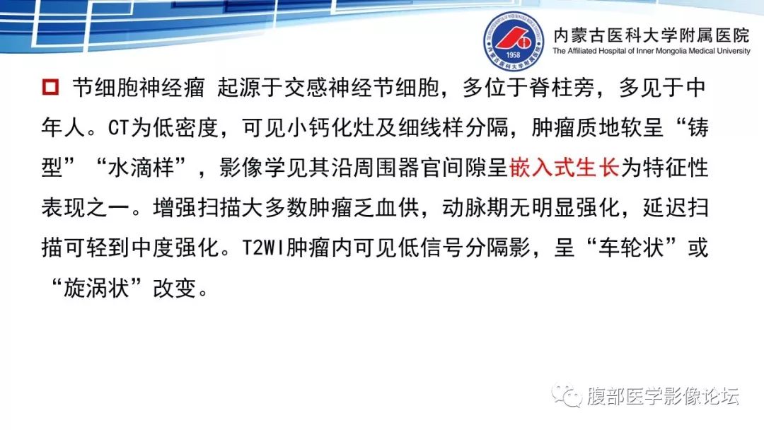 【PPT】腹膜后孤立性纤维瘤的影像