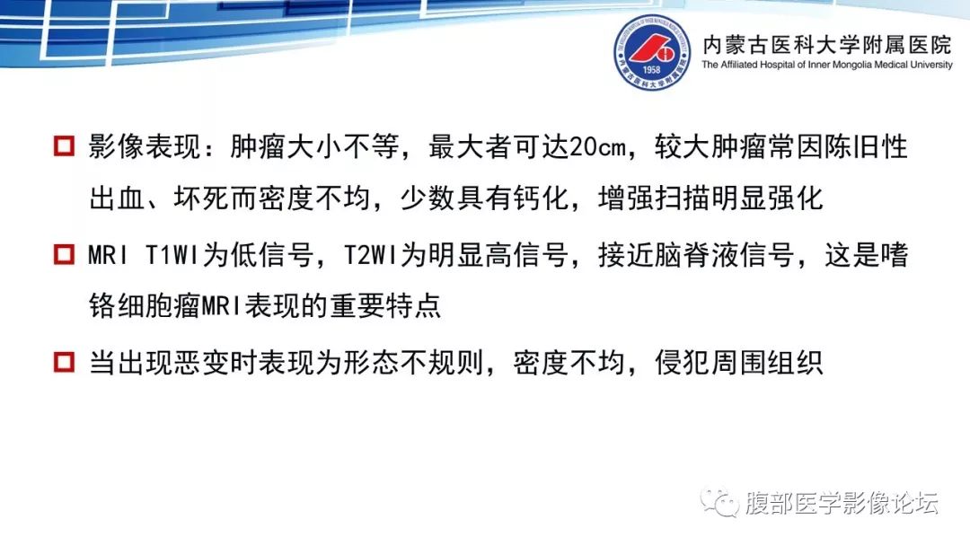 【PPT】腹膜后孤立性纤维瘤的影像