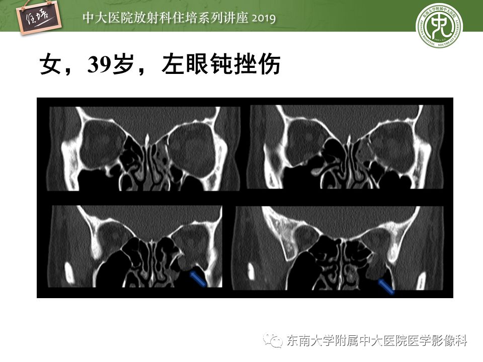 【PPT】成人颅脑损伤影像评估基本原则
