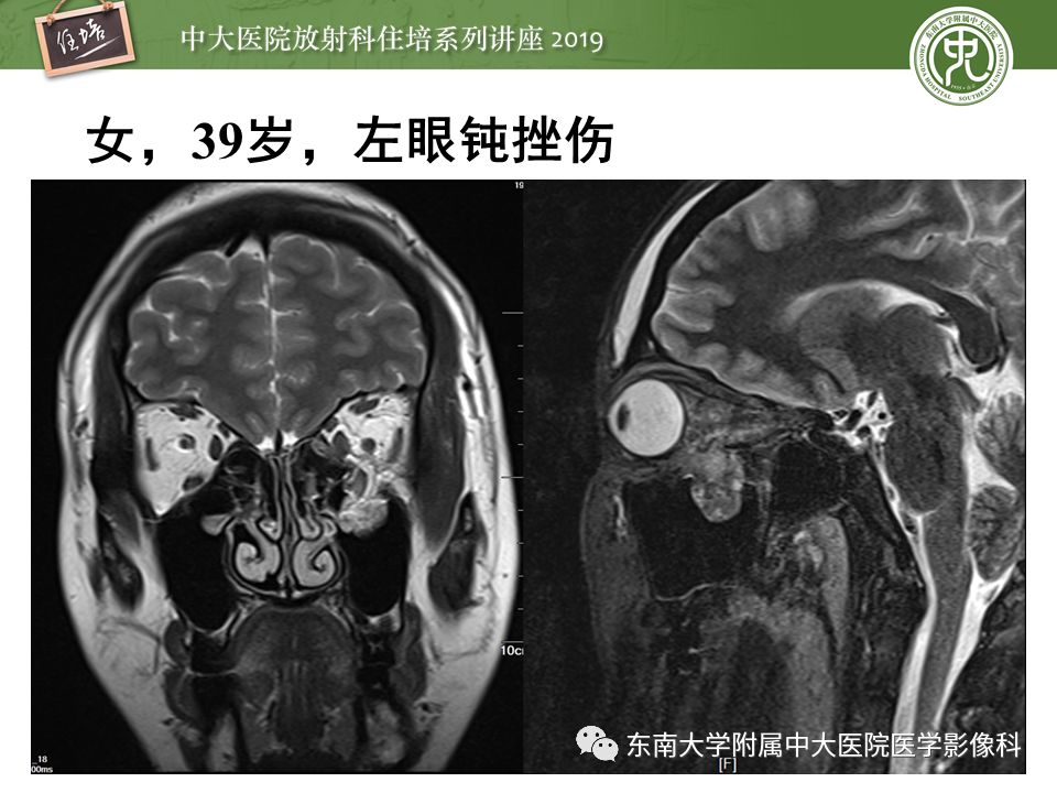 【PPT】成人颅脑损伤影像评估基本原则