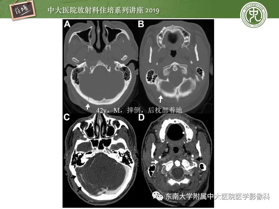 【PPT】成人颅脑损伤影像评估基本原则