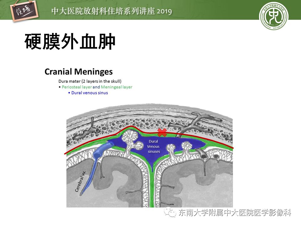 【PPT】成人颅脑损伤影像评估基本原则
