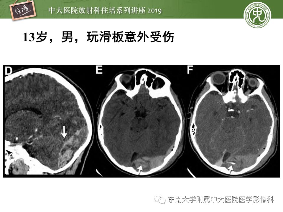 【PPT】成人颅脑损伤影像评估基本原则