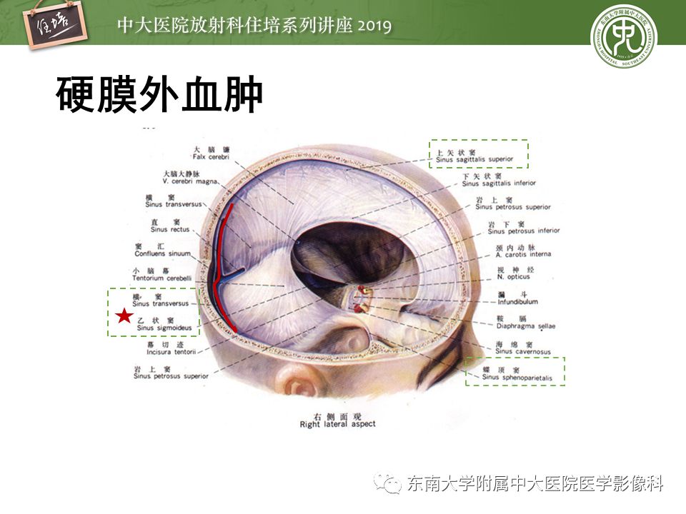 【PPT】成人颅脑损伤影像评估基本原则