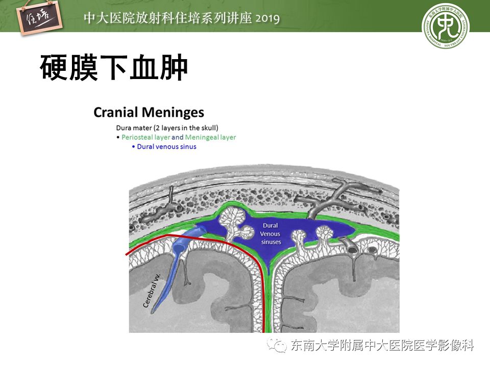 【PPT】成人颅脑损伤影像评估基本原则
