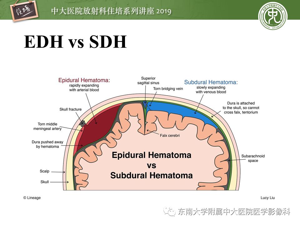 【PPT】成人颅脑损伤影像评估基本原则