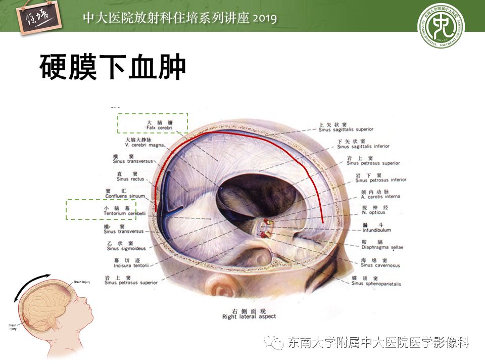 【PPT】成人颅脑损伤影像评估基本原则