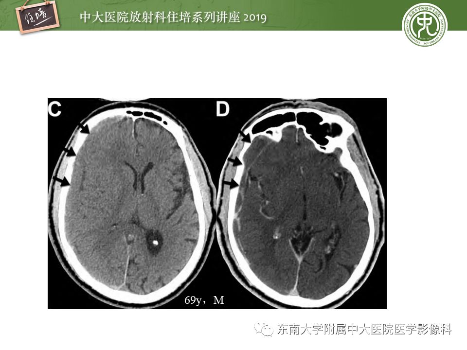 【PPT】成人颅脑损伤影像评估基本原则
