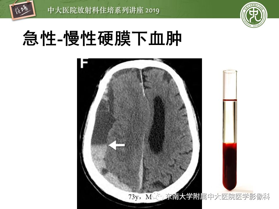 【PPT】成人颅脑损伤影像评估基本原则