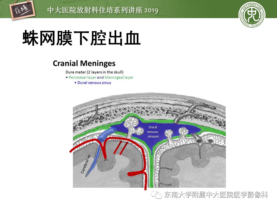 【PPT】成人颅脑损伤影像评估基本原则