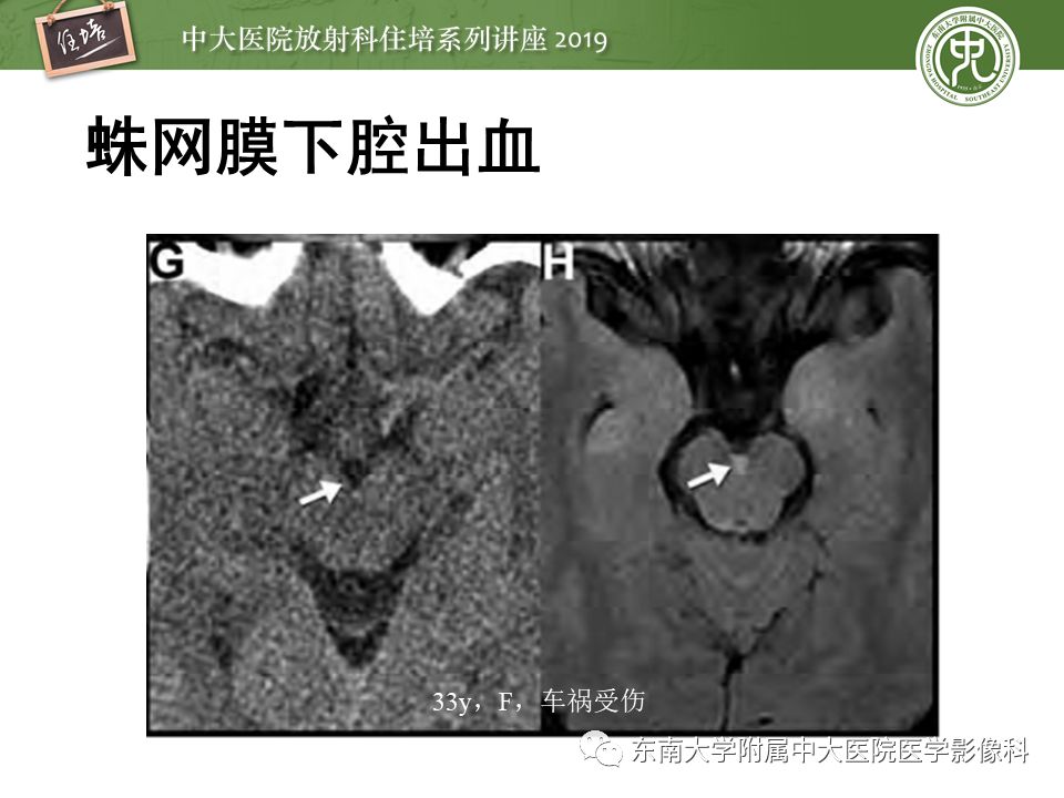 【PPT】成人颅脑损伤影像评估基本原则