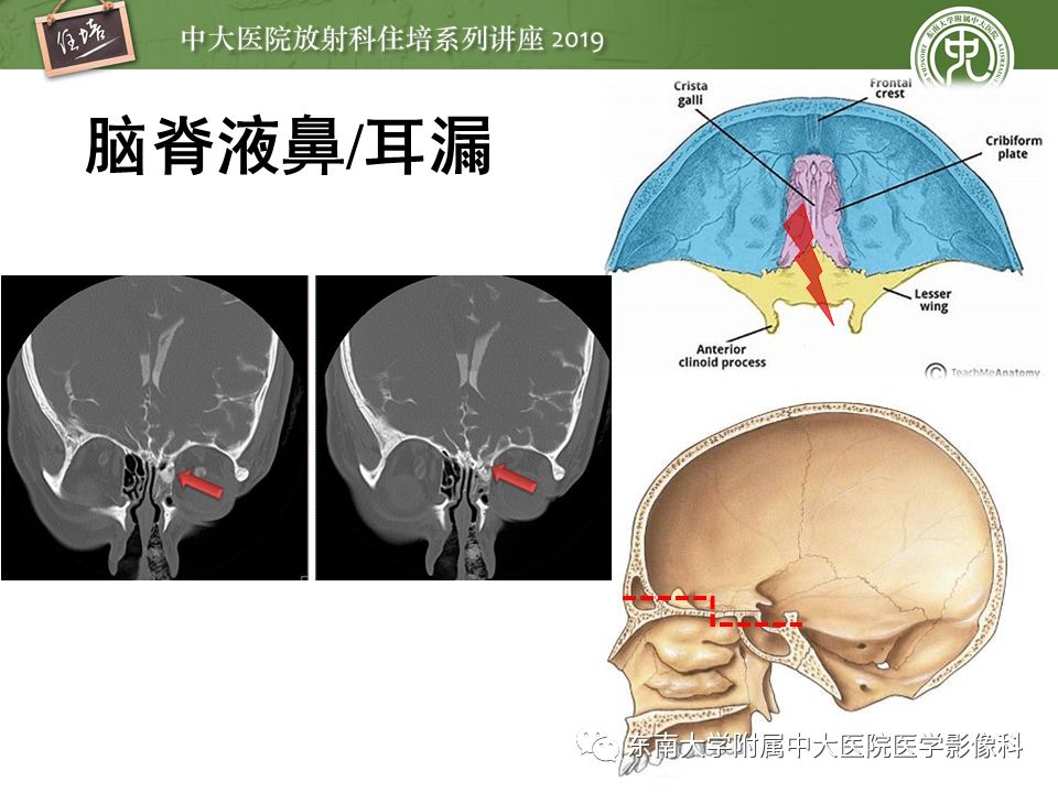 【PPT】成人颅脑损伤影像评估基本原则