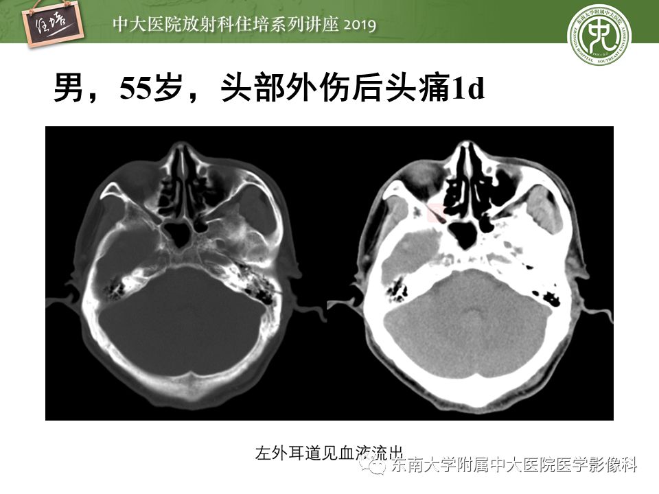 【PPT】成人颅脑损伤影像评估基本原则