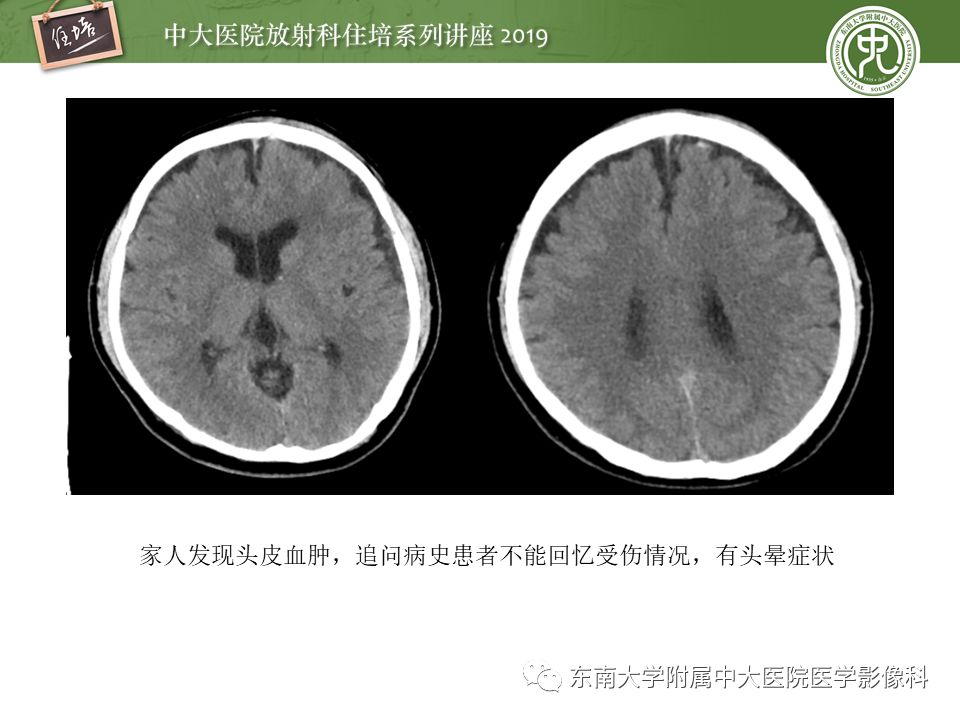 【PPT】成人颅脑损伤影像评估基本原则