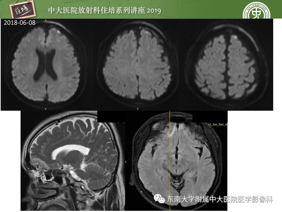 【PPT】成人颅脑损伤影像评估基本原则