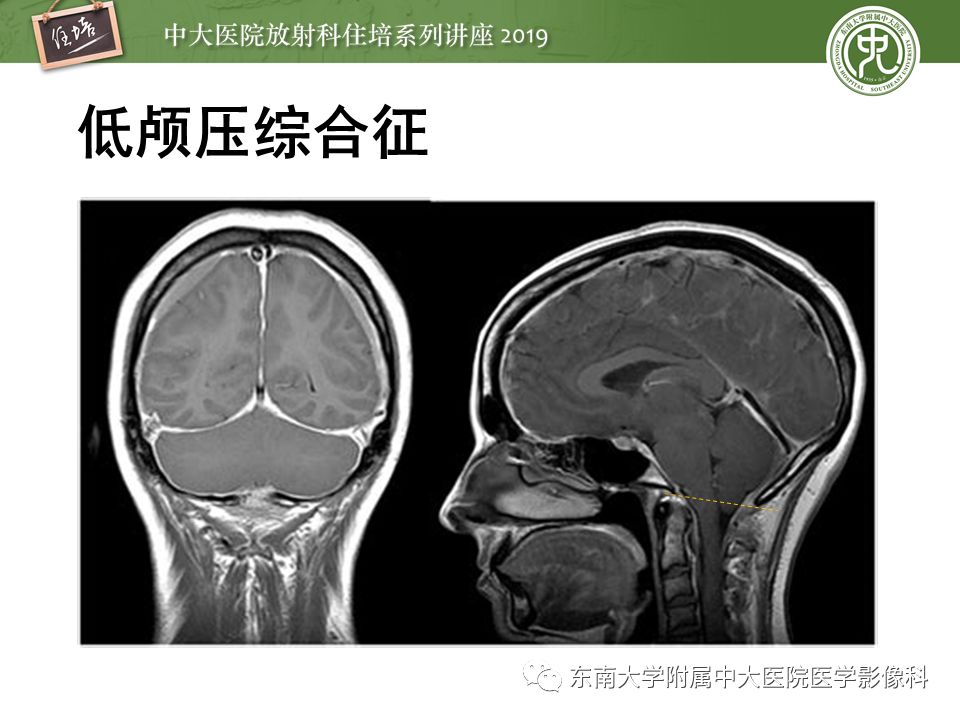 【PPT】成人颅脑损伤影像评估基本原则
