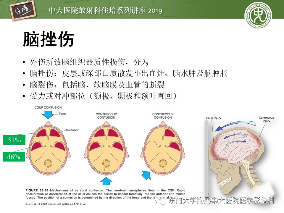 【PPT】成人颅脑损伤影像评估基本原则