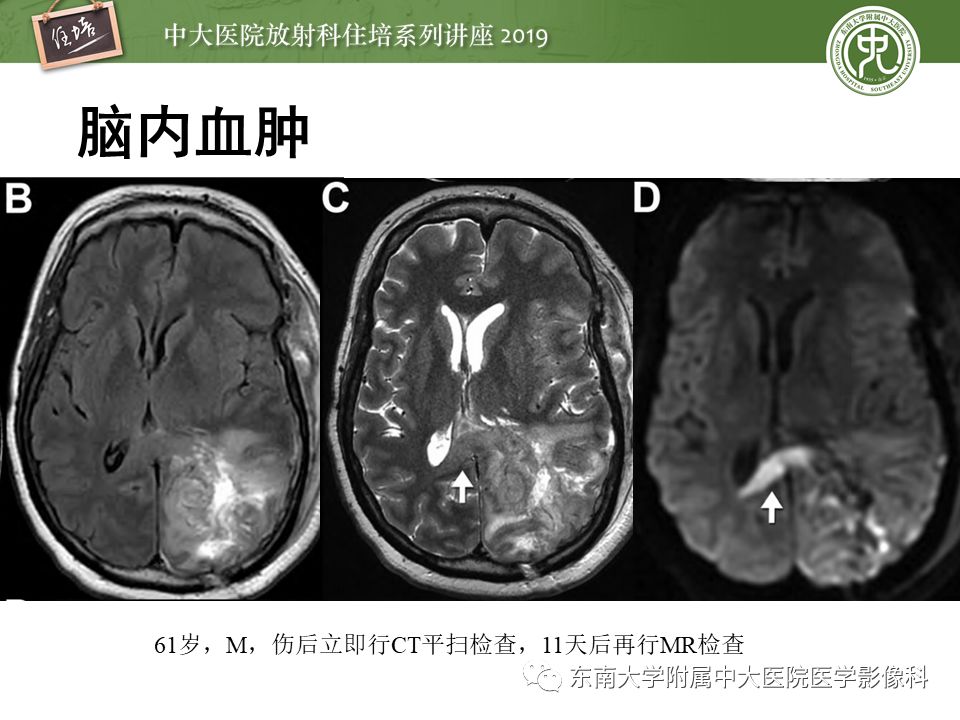 【PPT】成人颅脑损伤影像评估基本原则