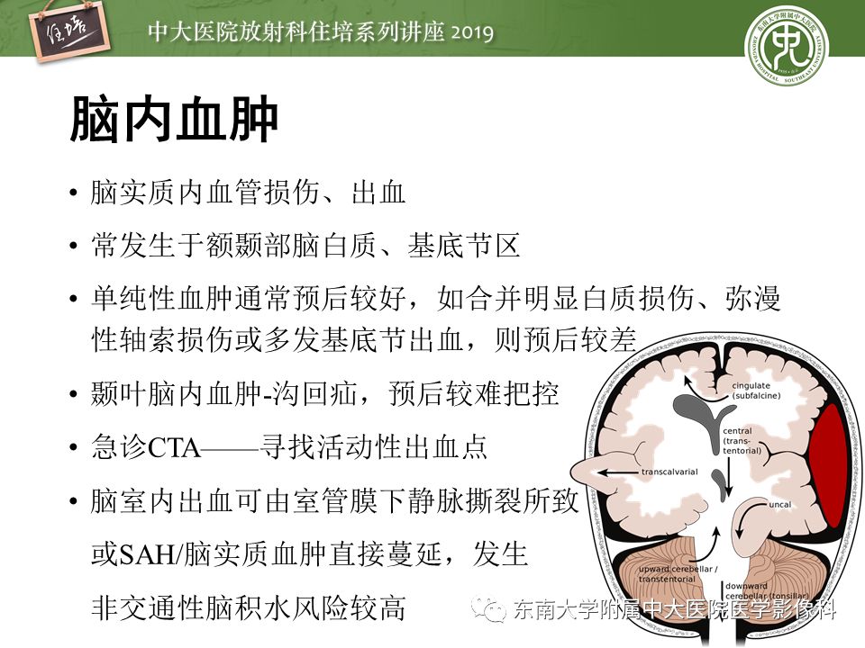 【PPT】成人颅脑损伤影像评估基本原则