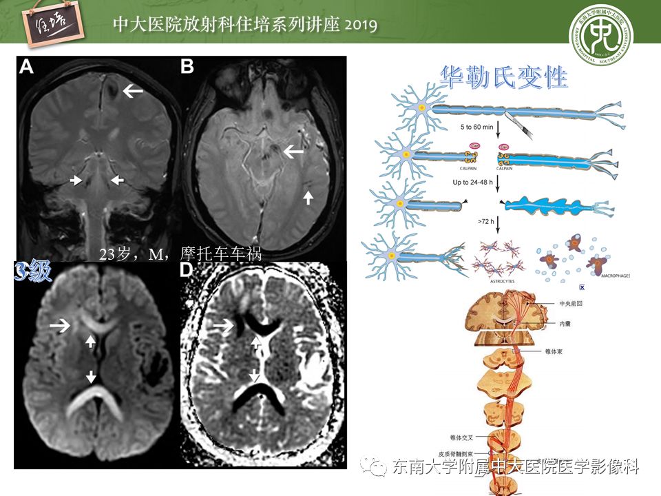 【PPT】成人颅脑损伤影像评估基本原则