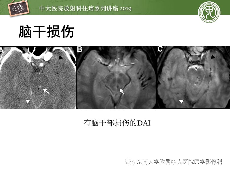 【PPT】成人颅脑损伤影像评估基本原则