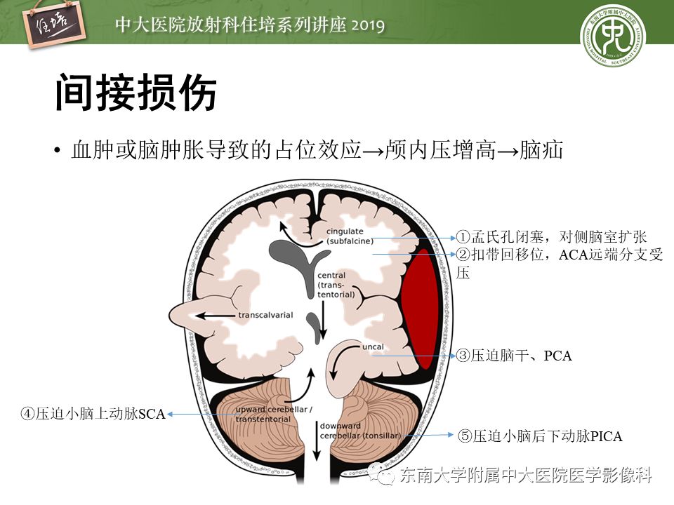 【PPT】成人颅脑损伤影像评估基本原则