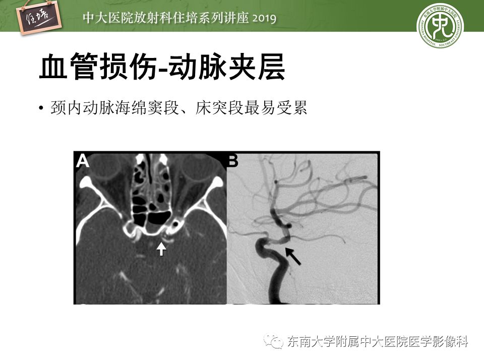 【PPT】成人颅脑损伤影像评估基本原则