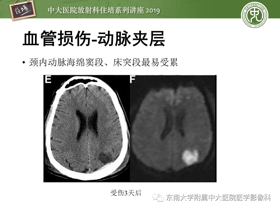 【PPT】成人颅脑损伤影像评估基本原则