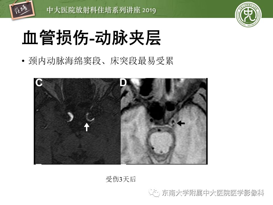 【PPT】成人颅脑损伤影像评估基本原则