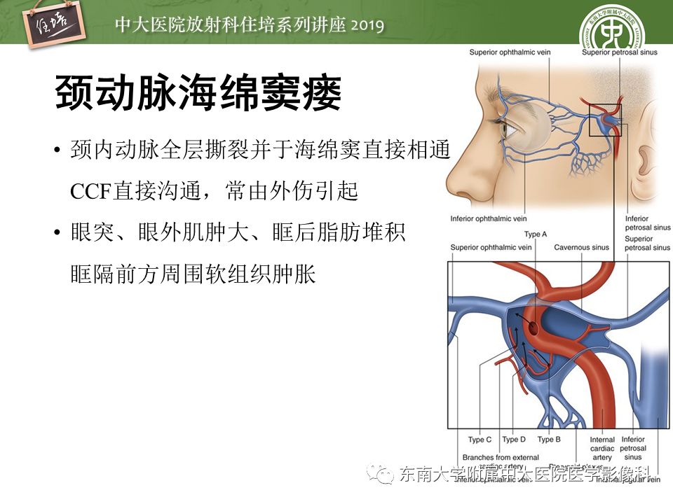【PPT】成人颅脑损伤影像评估基本原则