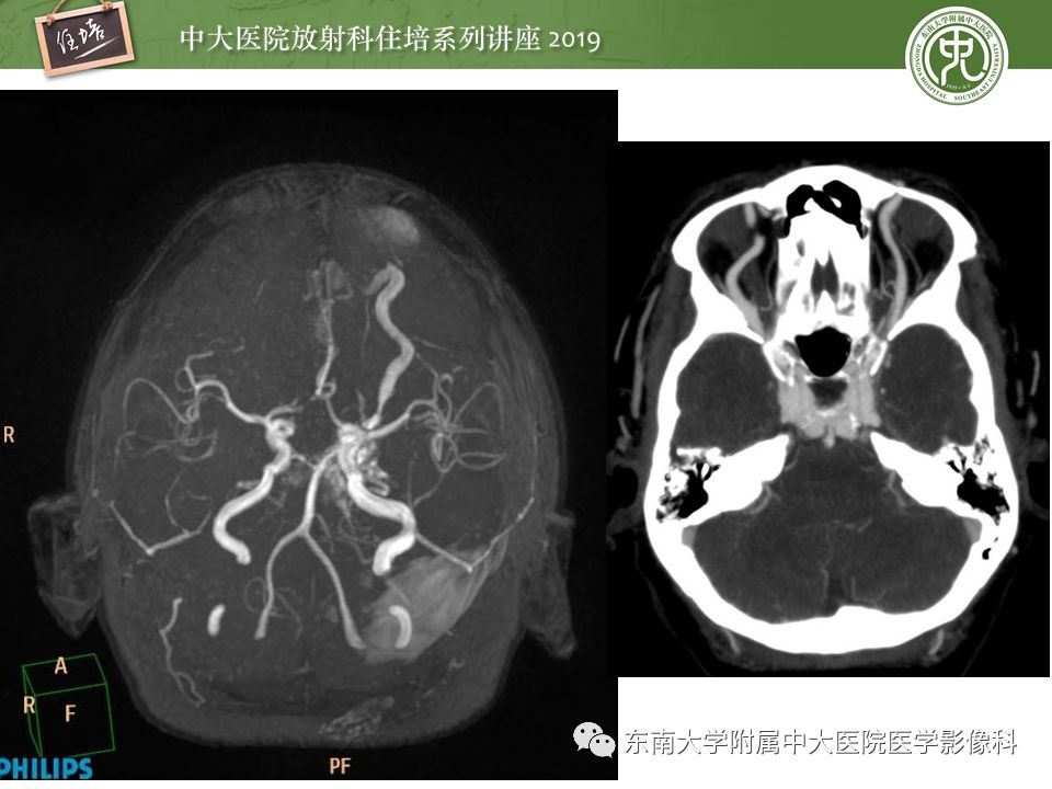 【PPT】成人颅脑损伤影像评估基本原则
